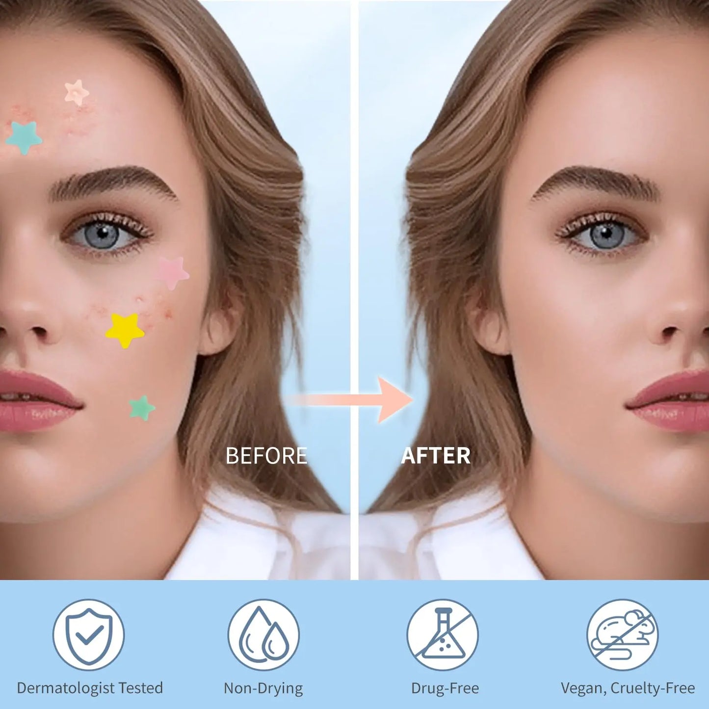 QUSTERE Pimple Patches for Face, Hydrocolloid Acne Patches