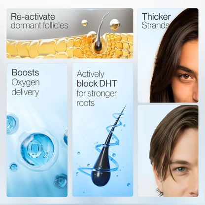 Advanced Hair Growth Serum Roll On - 3% Redensyl, 3% Rosemary (25 ml)