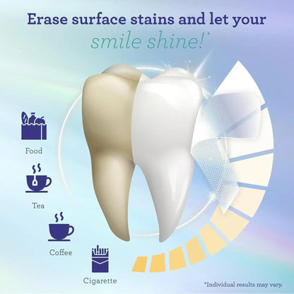 Whitening Strips – 7 Day Treatment